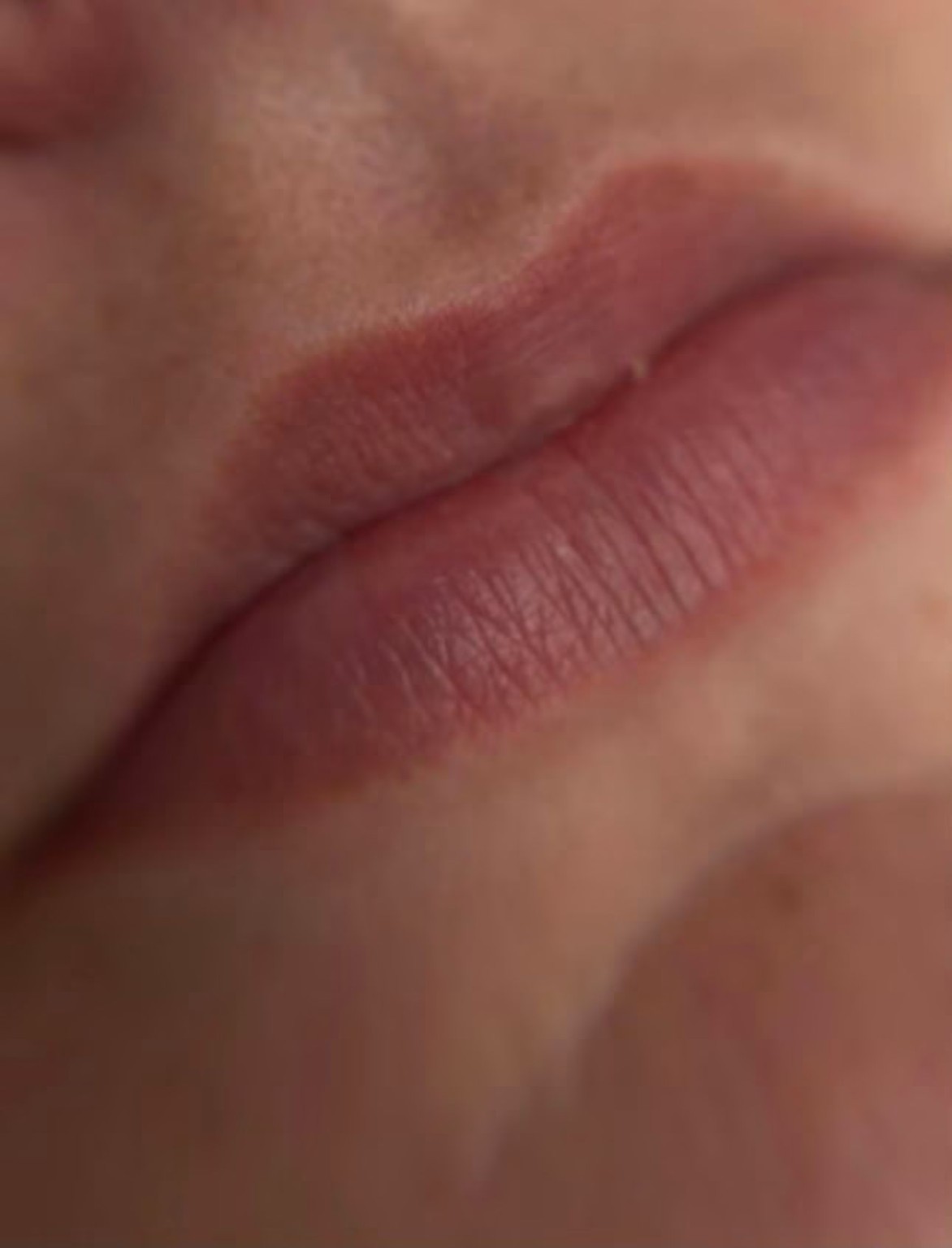 Lips before lip blushing