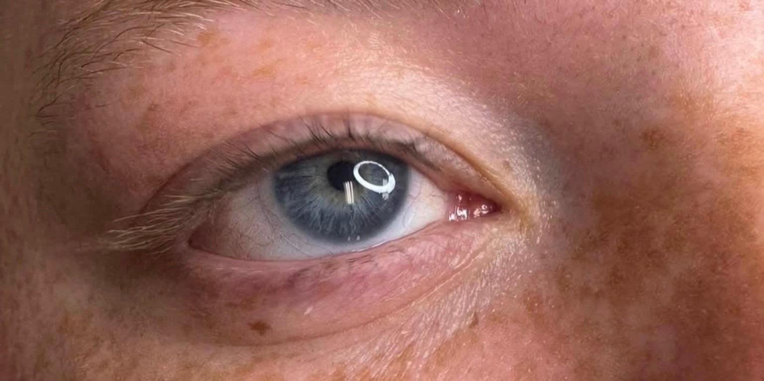 Eye before permanent eyeliner