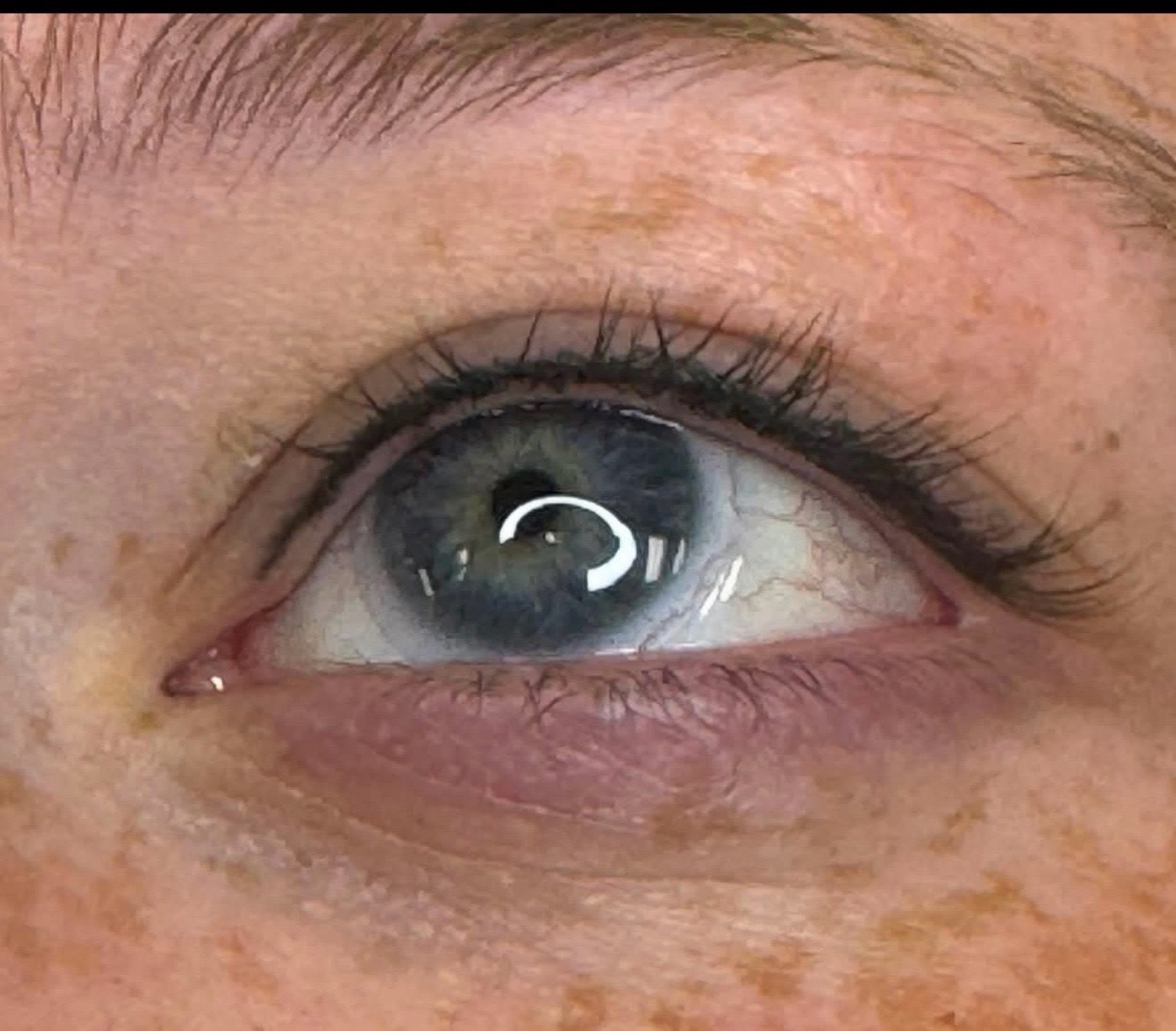 Eye after permanent eyeliner